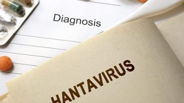 سندرم ریوی Hantavirus یک عفونت ویروسی نادر اما کشنده است