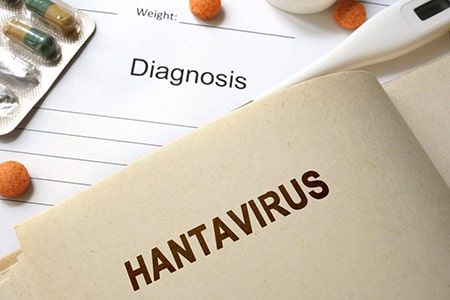 سندرم ریوی Hantavirus یک عفونت ویروسی نادر اما کشنده است